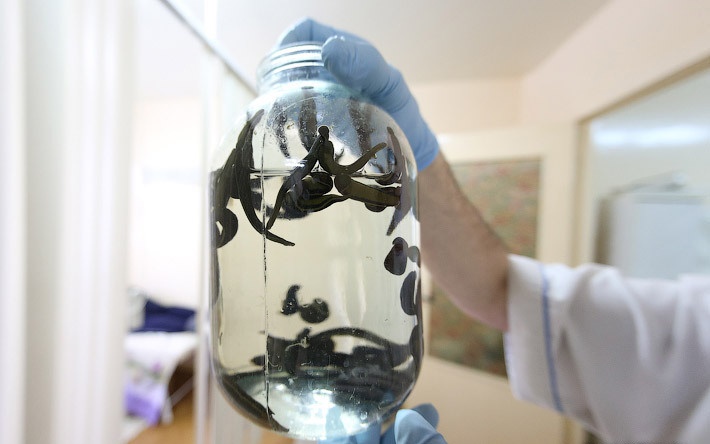 Где купить медицинские пиявки в Москве